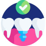 Realizzazione e Applicazione dei Denti Fissi